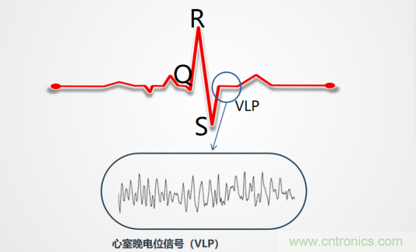 解決心電監測行業難題，曼森伯格的濾波技術獲國家知識產權局發明授權